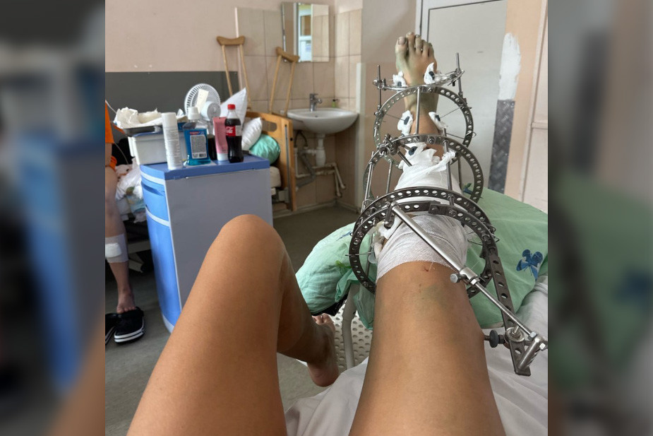 После того, как А. сбил Марию, ей провели три операции