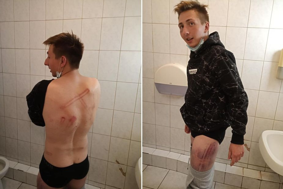 Следы избиений