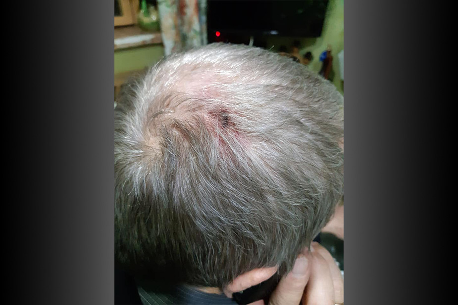 Александр Бехтольд